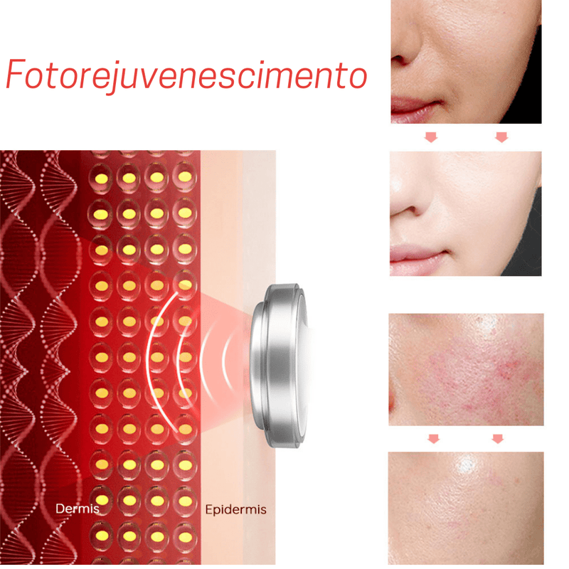 Aparelho rejuvenescedor: anti rugas e anti sinais.